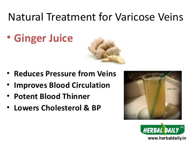 ginger for varicose veins ginger for varicose veins
